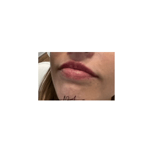 After Image