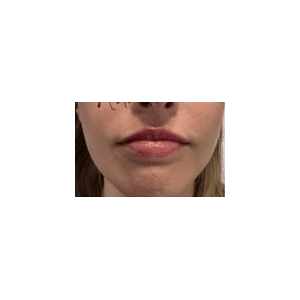 After Image