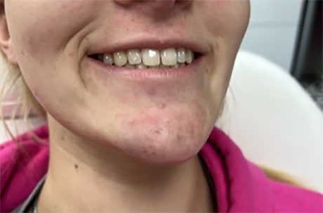 After Image
