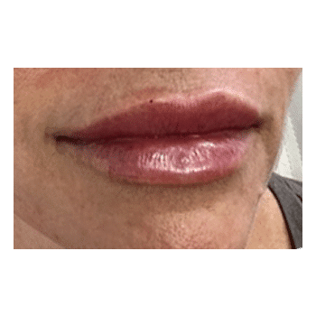 After Image
